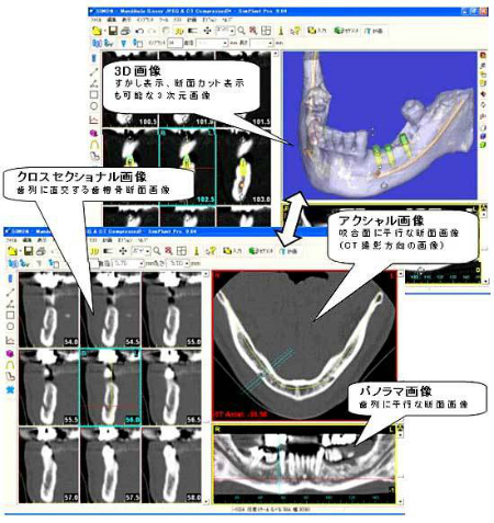 コンピュータシミュレーションの写真