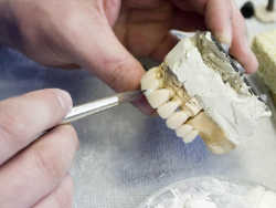 歯科技工士が歯を作っている写真