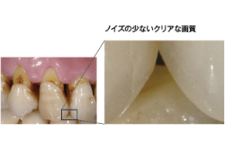 ノイズの少ないクリアな画質