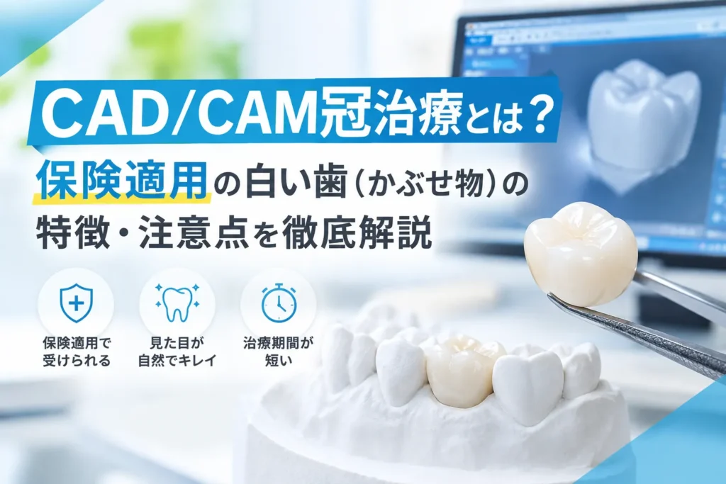 CAD/CAM冠治療とは？保険適用の白い歯（かぶせ物）の特徴・注意点を徹底解説