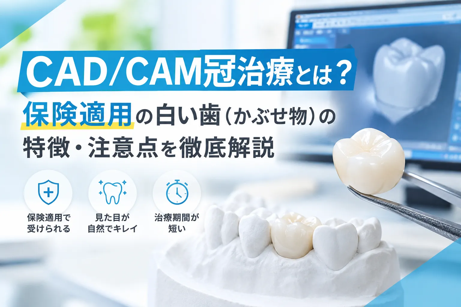 CAD/CAM冠治療とは？保険適用の白い歯（かぶせ物）の特徴・注意点を徹底解説